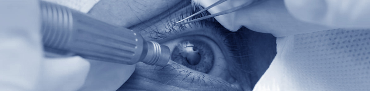 Cataract: Causes, Symptoms, and Surgery Options, lenses IOL