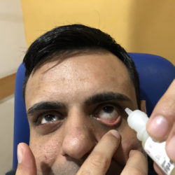 More about glaucoma medication