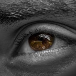 puffiness, pigmentation, under eye bags