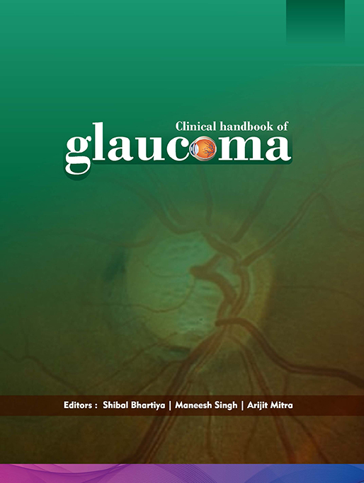 Clinical handbook of glaucoma, glaucoma Management. Dr Shibal Bhartiya