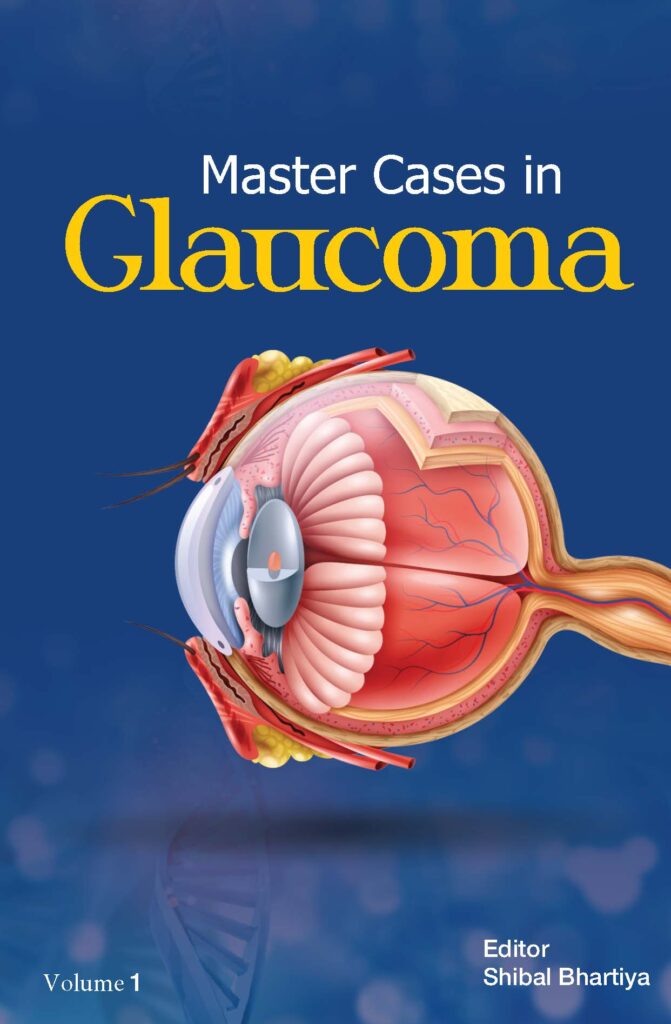 Master Cases in Glaucoma, Dr Shibal Bhartiya