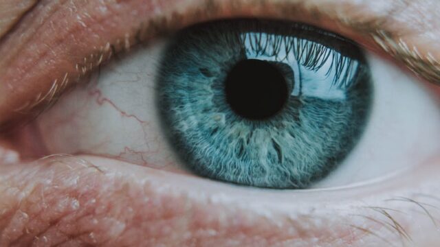 Meibomian Gland Disease