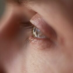 contact lenses and glaucoma dr shibal bhartiya, best glaucoma specialist in gurgaon
