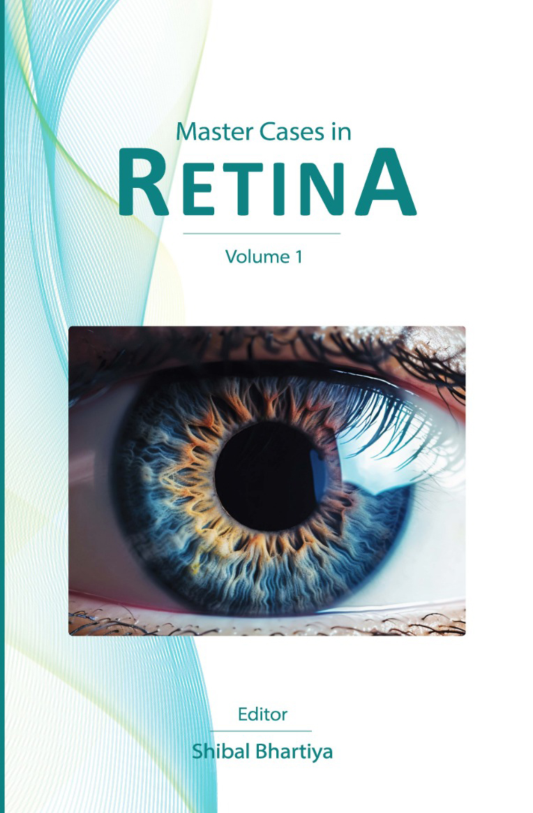 Master Cases in retina, Clinical Decision Making, Author Dr Shibal Bhartiya, Fellowship trained glaucoma surgeon, second opinion, advanced care