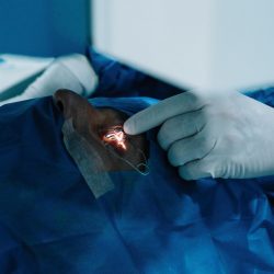 When I Recommend Surgery & When I Don't, dr shibal bhartiya, best glaucoma doctor in gurgaon