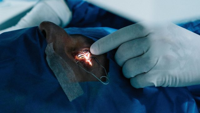 When I Recommend Surgery & When I Don't, dr shibal bhartiya, best glaucoma doctor in gurgaon