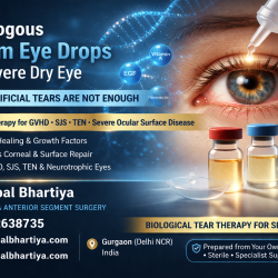 utologous serum eyedrops severe dry eye ocualr gvhd tens steven johnsons symdrome glaucoma specialist gurgaon dr shibal bhartiya